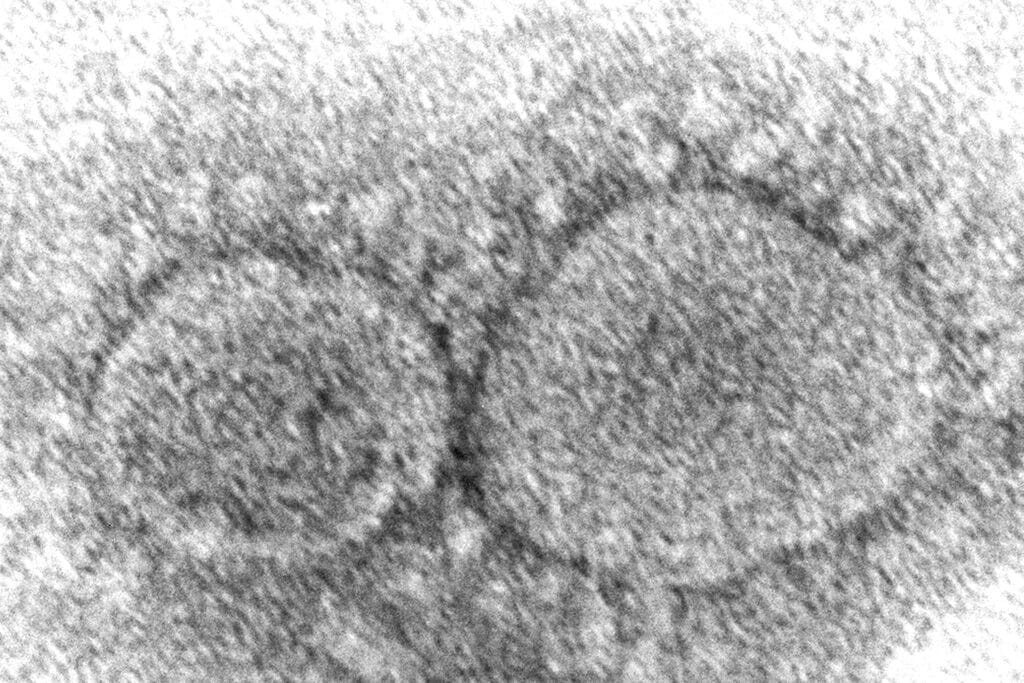 coronavirus mutant